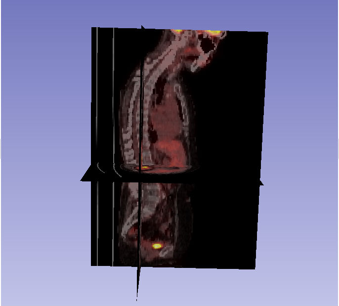 PETCT2.jpg