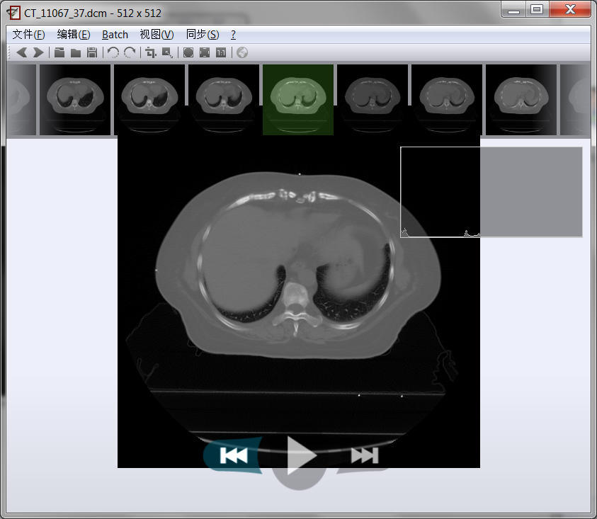 nomacs-dicom-v0.1.jpg