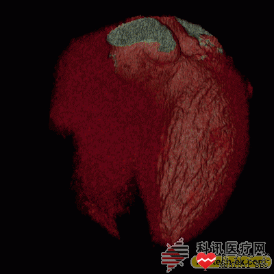 20150113091002582.gif