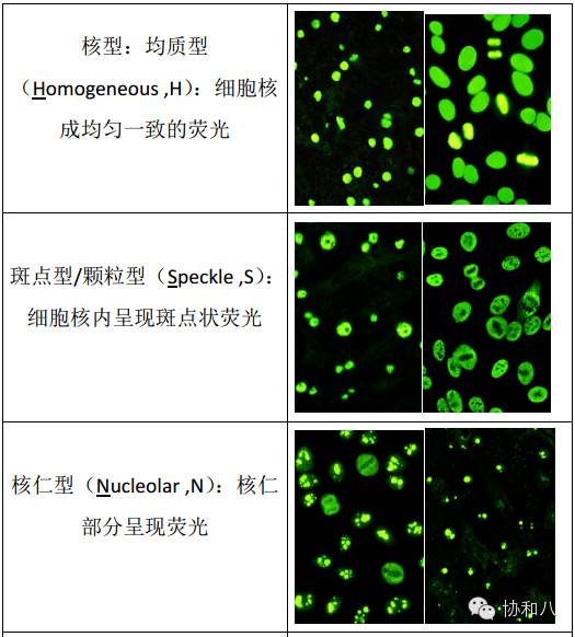 如何才能读懂你,我的抗核抗体