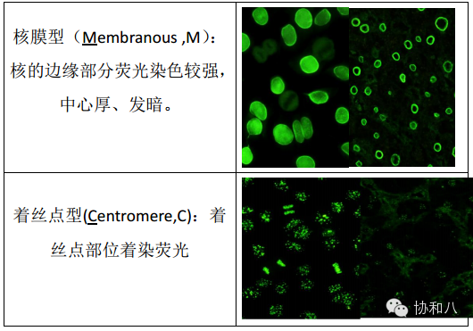 如何才能读懂你,我的抗核抗体