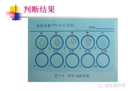 梅毒抗体和滴度检测在梅毒诊断和治疗中的应用