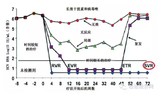 HCV感染诊断和管理中的检测问题之病例3