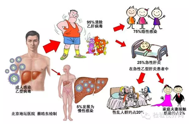 详解乙型肝炎的性传播
