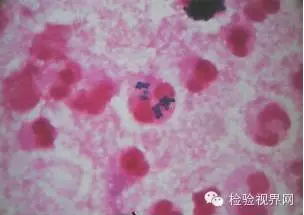 细菌检验对临床的重要性
