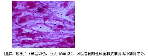 了解病原体，“看明白”肺炎