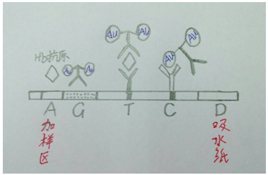 【检验临床面对面】检验人，请不要忽视粪便隐血试验中的“钩状效应” ...