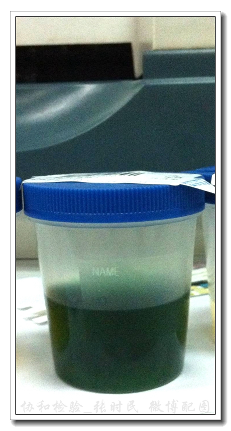 那些你没见过的奇葩颜色的尿