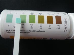 尿糖，如何科学分析？