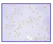 “自相矛盾”的尿常规