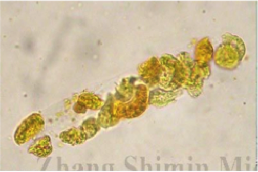 尿沉渣的世界你懂吗？