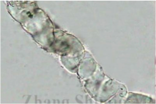 尿沉渣的世界你懂吗？