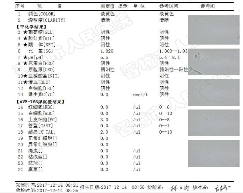 【检验临床面对面】让人揪心的尿蛋白