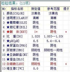 【检验临床面对面】让人揪心的尿蛋白