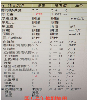【检验临床面对面】“消失”的尿蛋白
