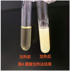 【检验临床面对面】“消失”的尿蛋白