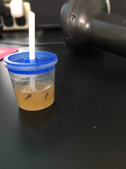 【检验临床面对面】粪便标本中的神秘生物
