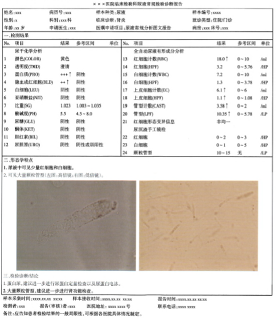 尿液常规检验诊断报告模式专家共识