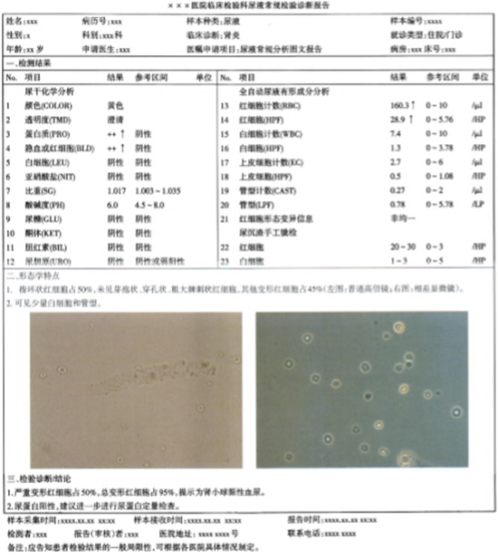 尿液常规检验诊断报告模式专家共识