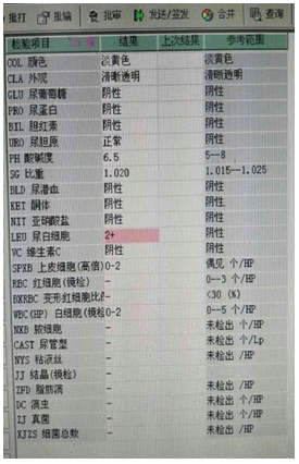 【检验临床面对面】 宝宝来做尿常规，真凶却藏在这！
