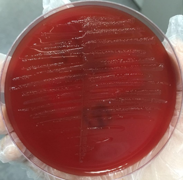 【检验临床面对面】最熟悉的陌生人