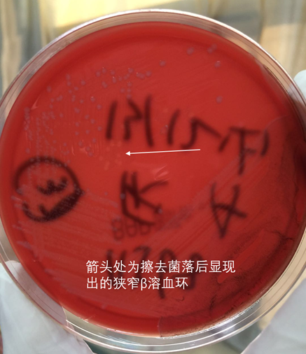 【检验临床面对面】初识产单核细胞李斯特菌