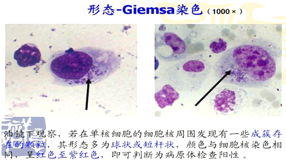 【检验临床面对面】小小的虫子叮了口，不疼不痒却险些丧命 ...