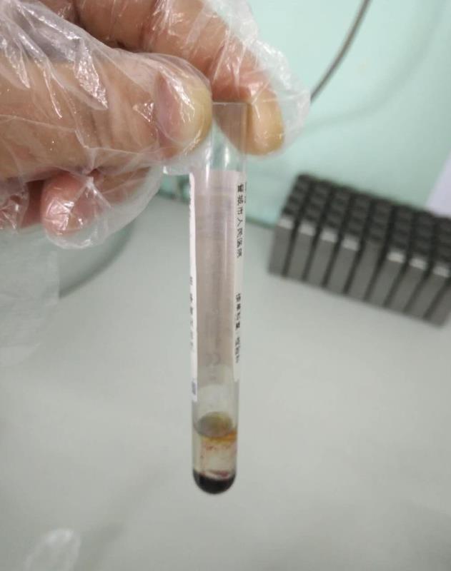 【检验临床面对面】逆天的电解质？！这个锅我们不背！