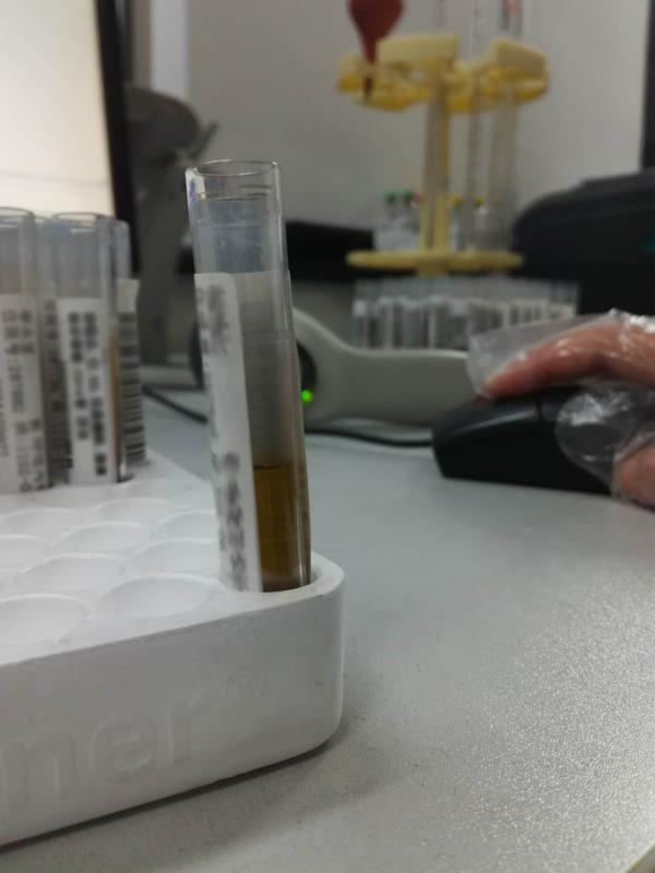 【检验临床面对面】逆天的电解质？！这个锅我们不背！