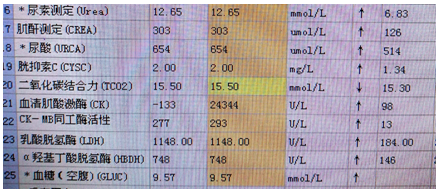 【检验临床面对面】CK结果的探究